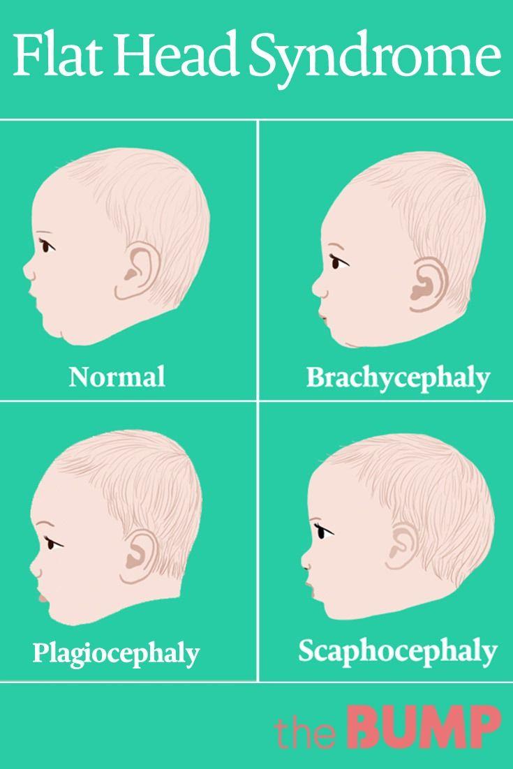 Is Flat Head Syndrome a Sign of Neglect? Debunking Myths