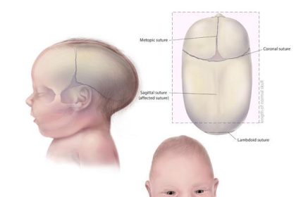 How to Shape Baby Head with Hands: Techniques and Tips