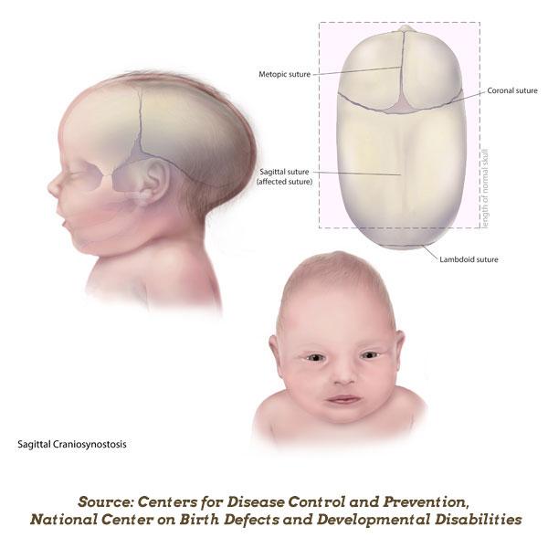 How to Shape Baby Head with Hands: Techniques and Tips