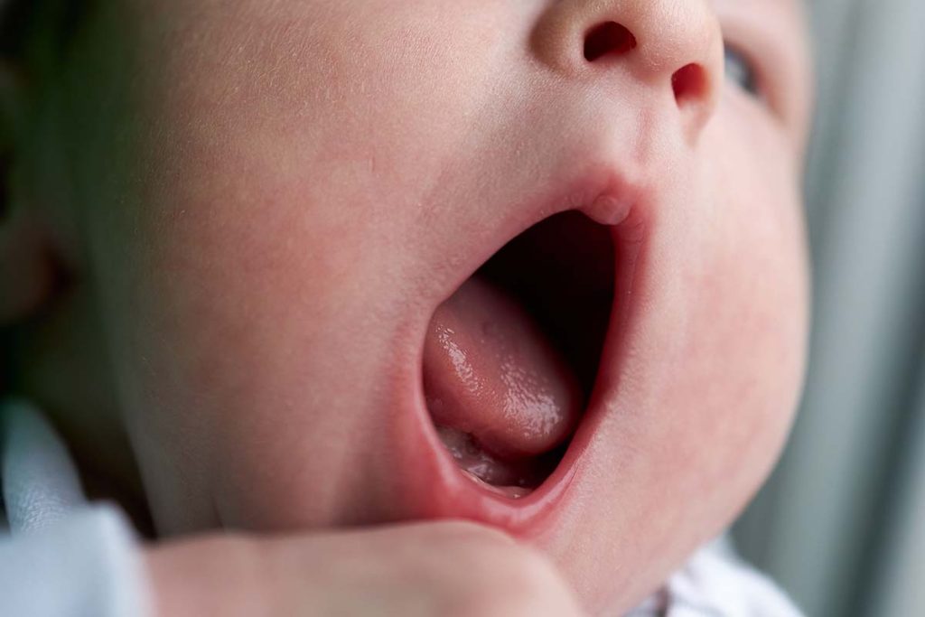 How to Clean Newborn Mouth