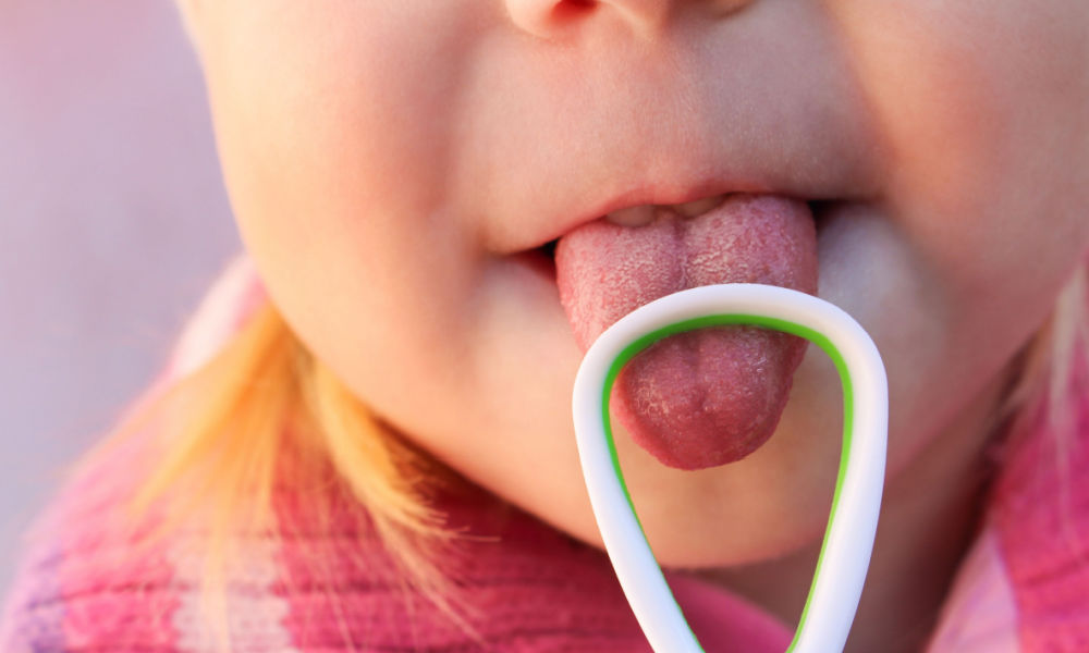 How to Get Milk Off Newborn Tongue